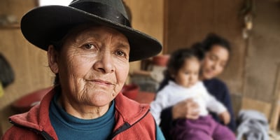 Smiles Movement Patient Story: Selvestrina From Union Santa Fe