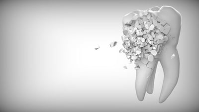 Chipped Tooth Repair: What You Need To Know